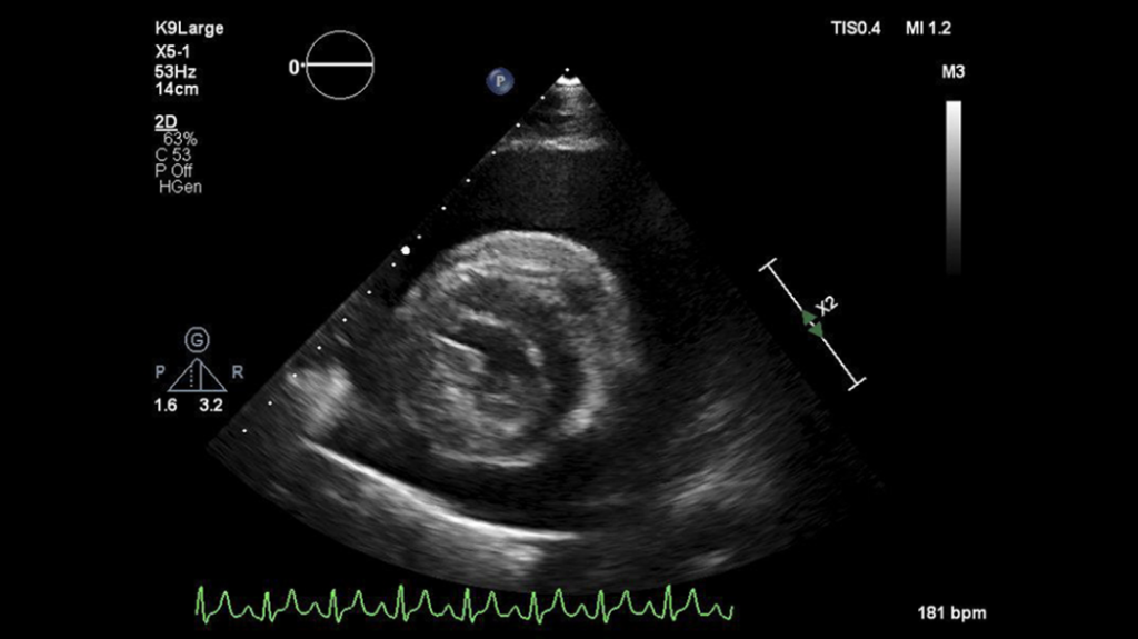Cross sectional echocardiographic image of a heart