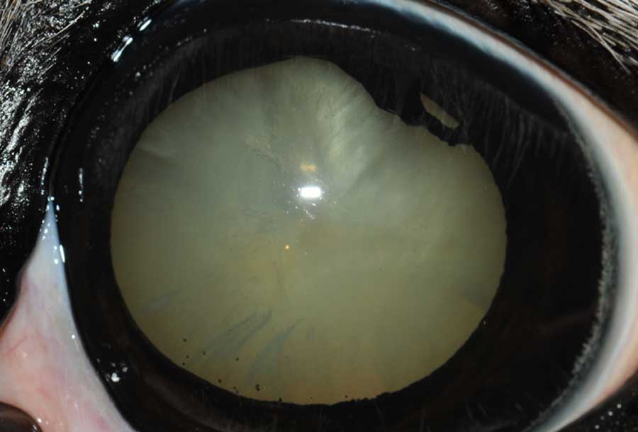 Mature cataract induced by ERU