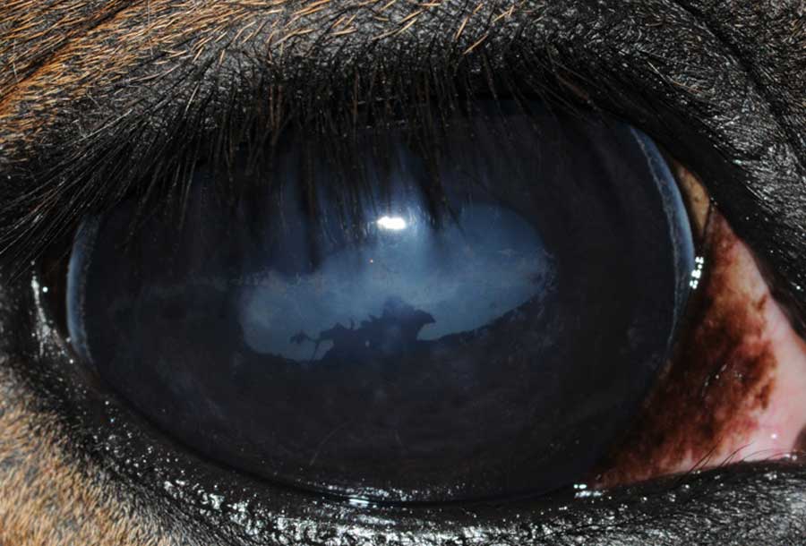 Corneal disease caused by steroid use and iridal damage due to ERU